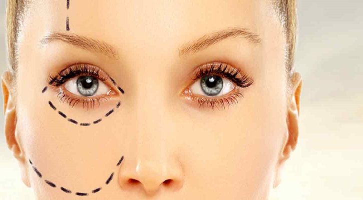 جراحی پلک در کلینیک های زیبایی چه تفاوتی با کلینیک چشم پزشکی دارد